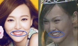 牙医爆料明星整牙视频